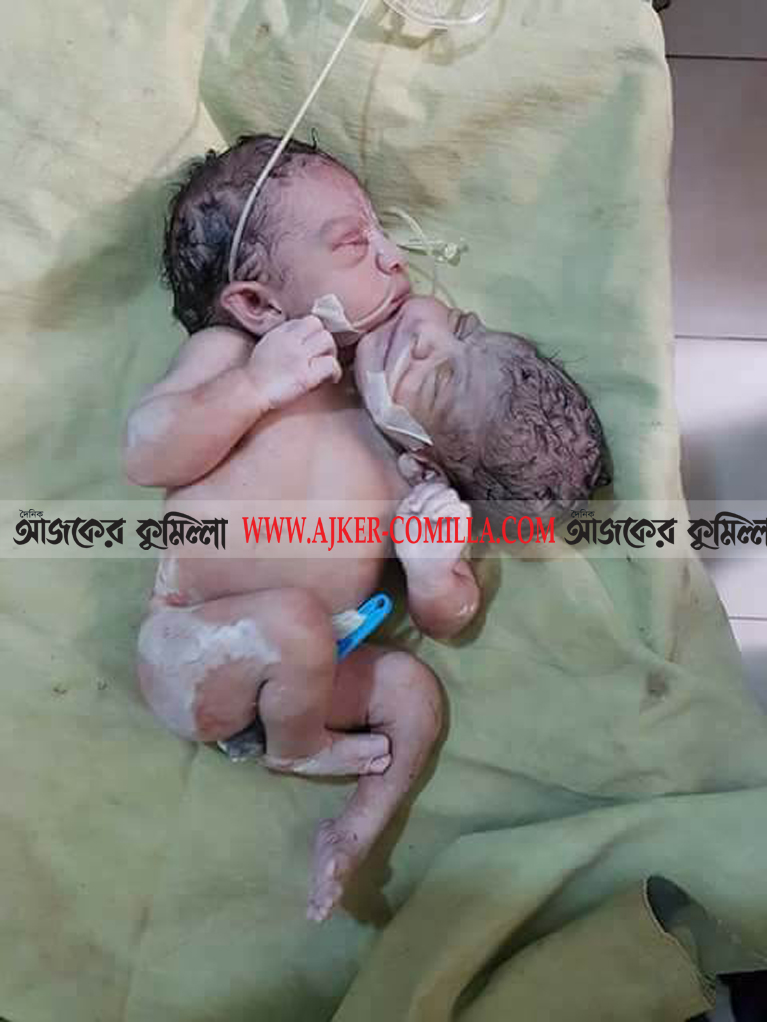 news-image